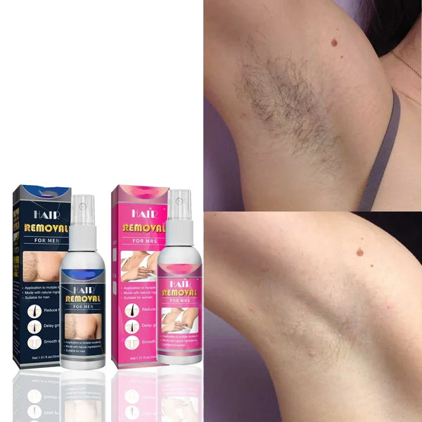 Body Hair Removal Spray